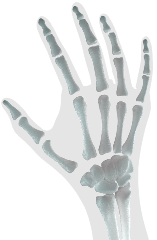 AI Radiology | Automated Bone Age Calculation