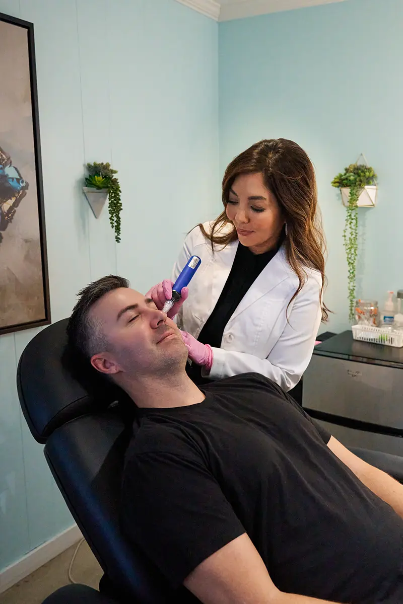 Katie Martin, PA-C performing microneedling treatment on a man's face in San Diego, CA