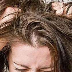 Scalp itchiness