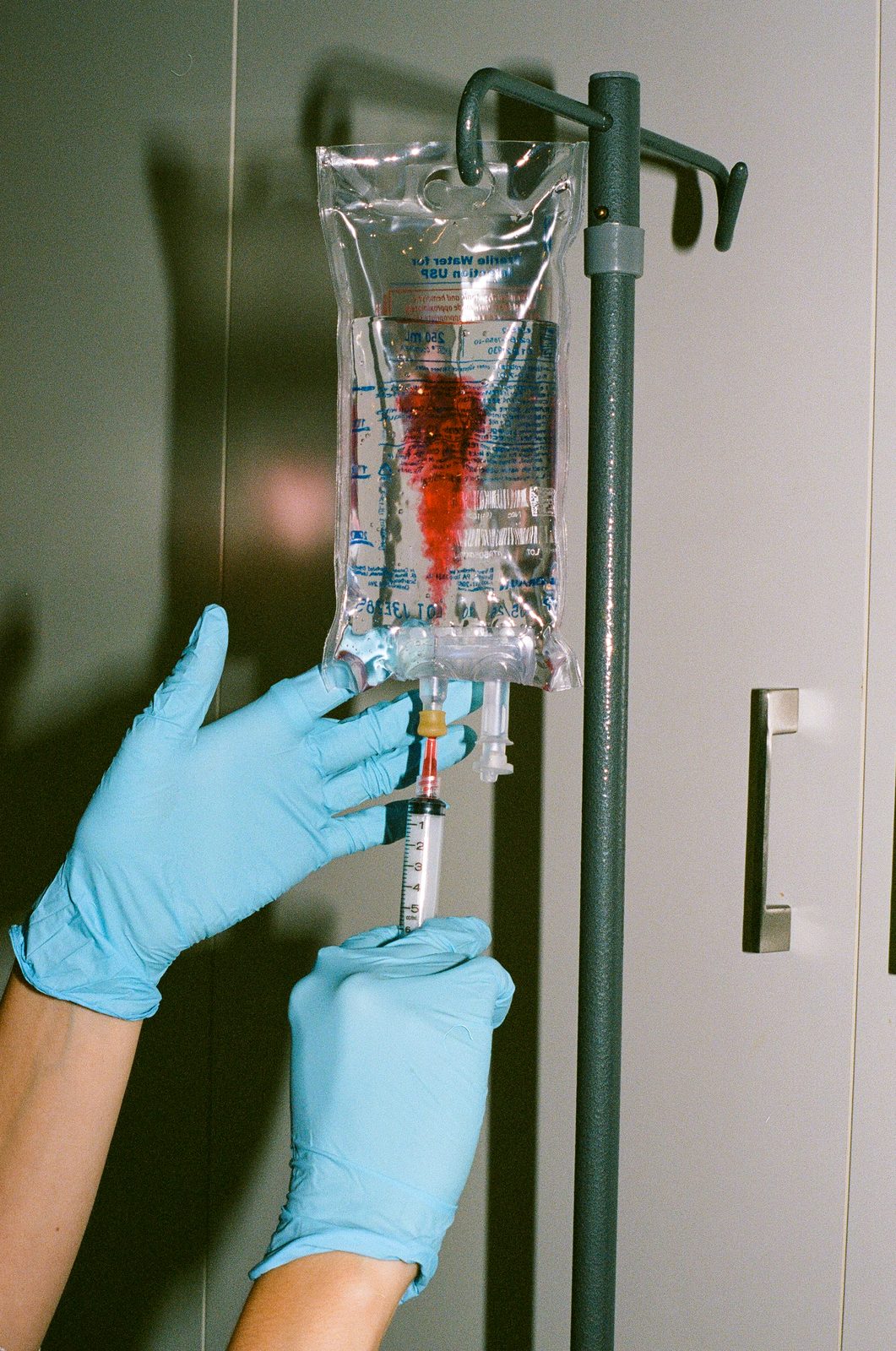IV iron treatment for low ferritin and iron-deficiency anemia in Toronto