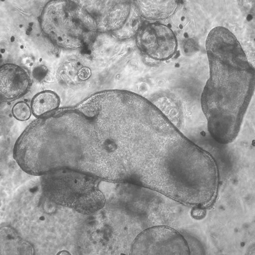 Liver organoid from 13LGS (Credit to Justin Conner)