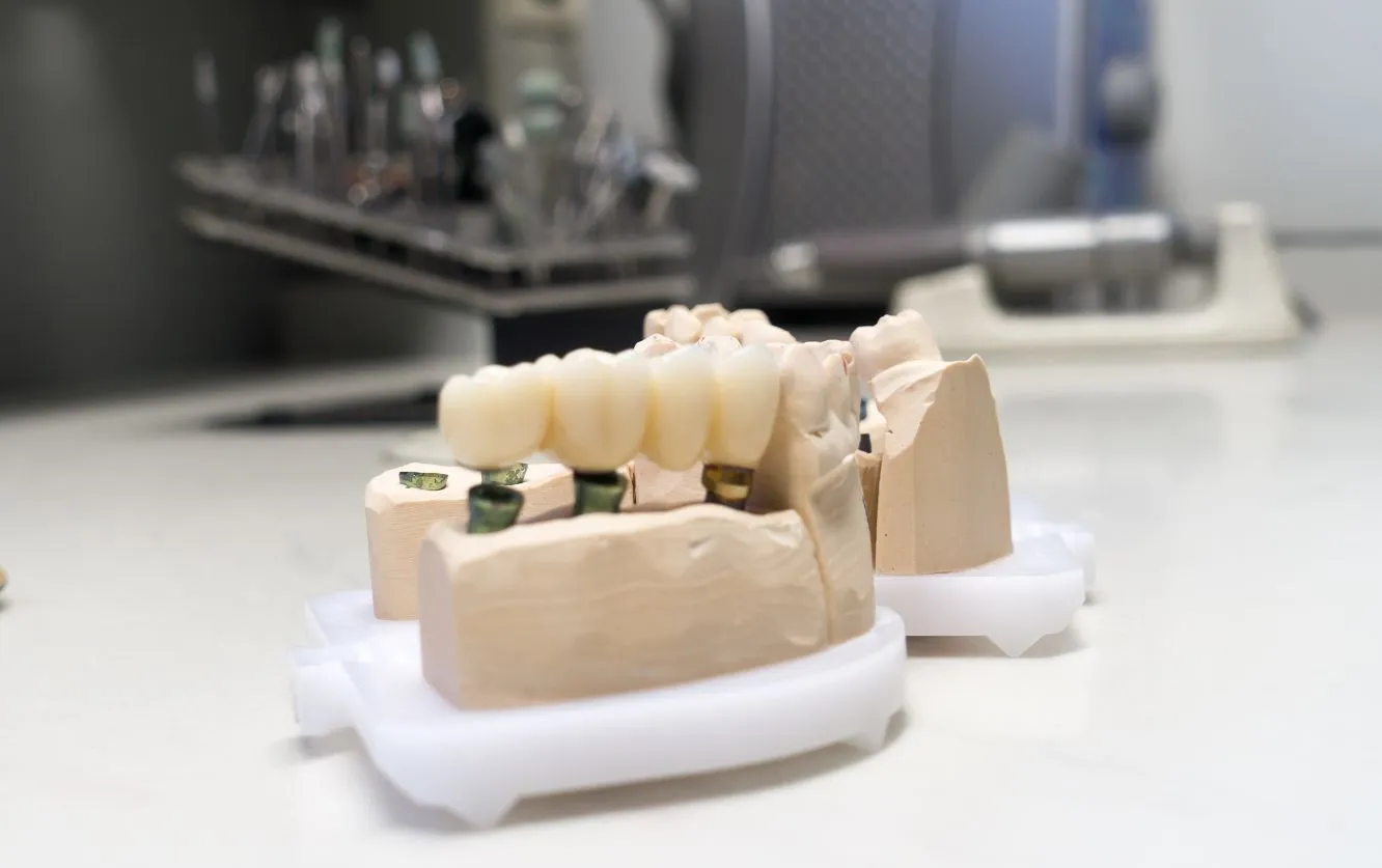 Close-up of ceramic dental crowns on a tray in a dental lab