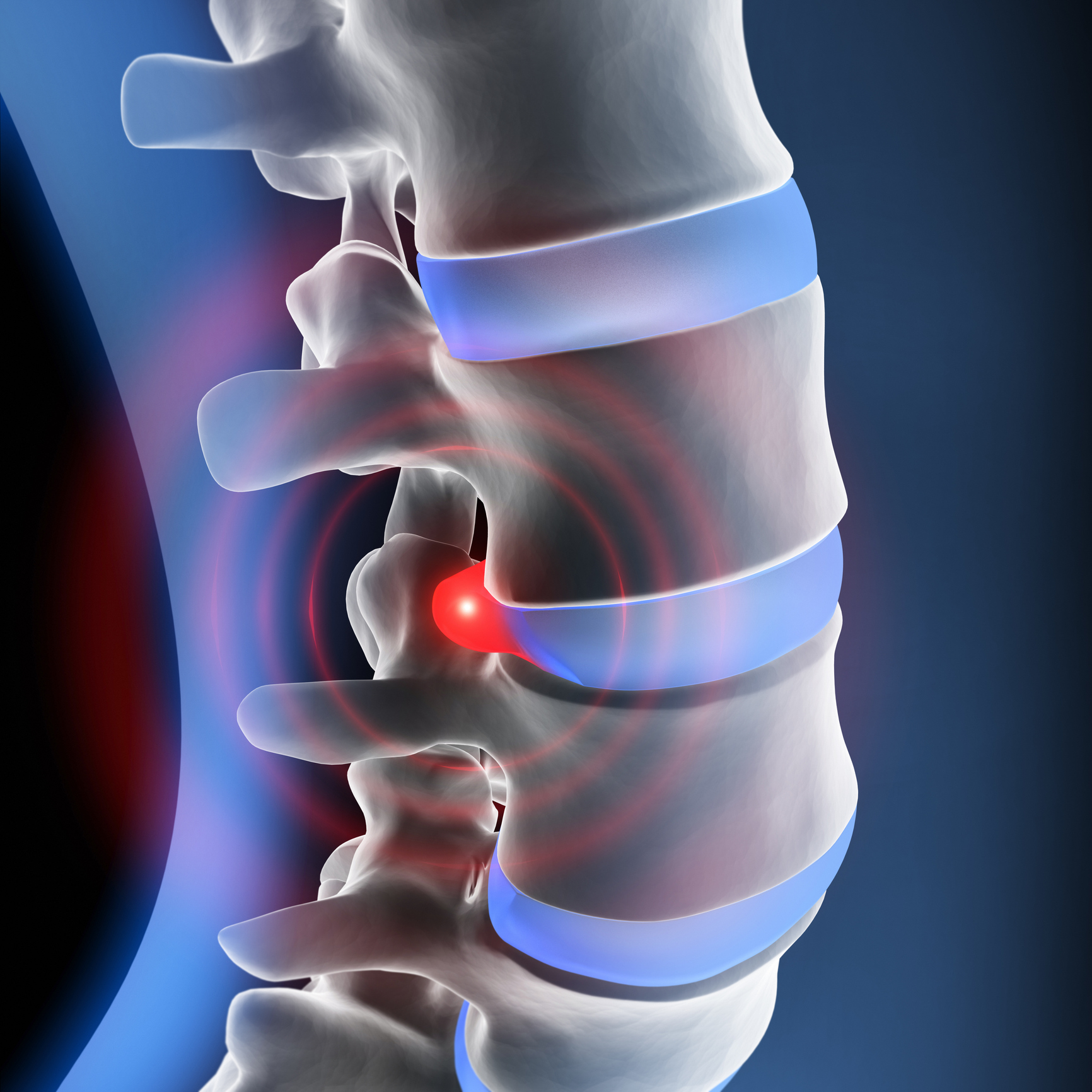 Diagnose und Therapie bei Bandscheibenvorfall und Skoliose – Orthopädicum Wien, Ihr Wirbelsäulenspezialist in Wien.