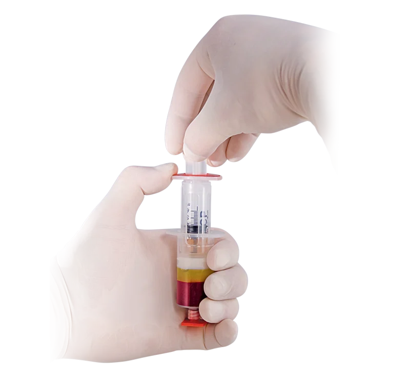 ACP-Therapie Knie – gezielte Eigenblutbehandlung zur Regeneration von Gelenken und Gewebe im Orthopädicum Wien.