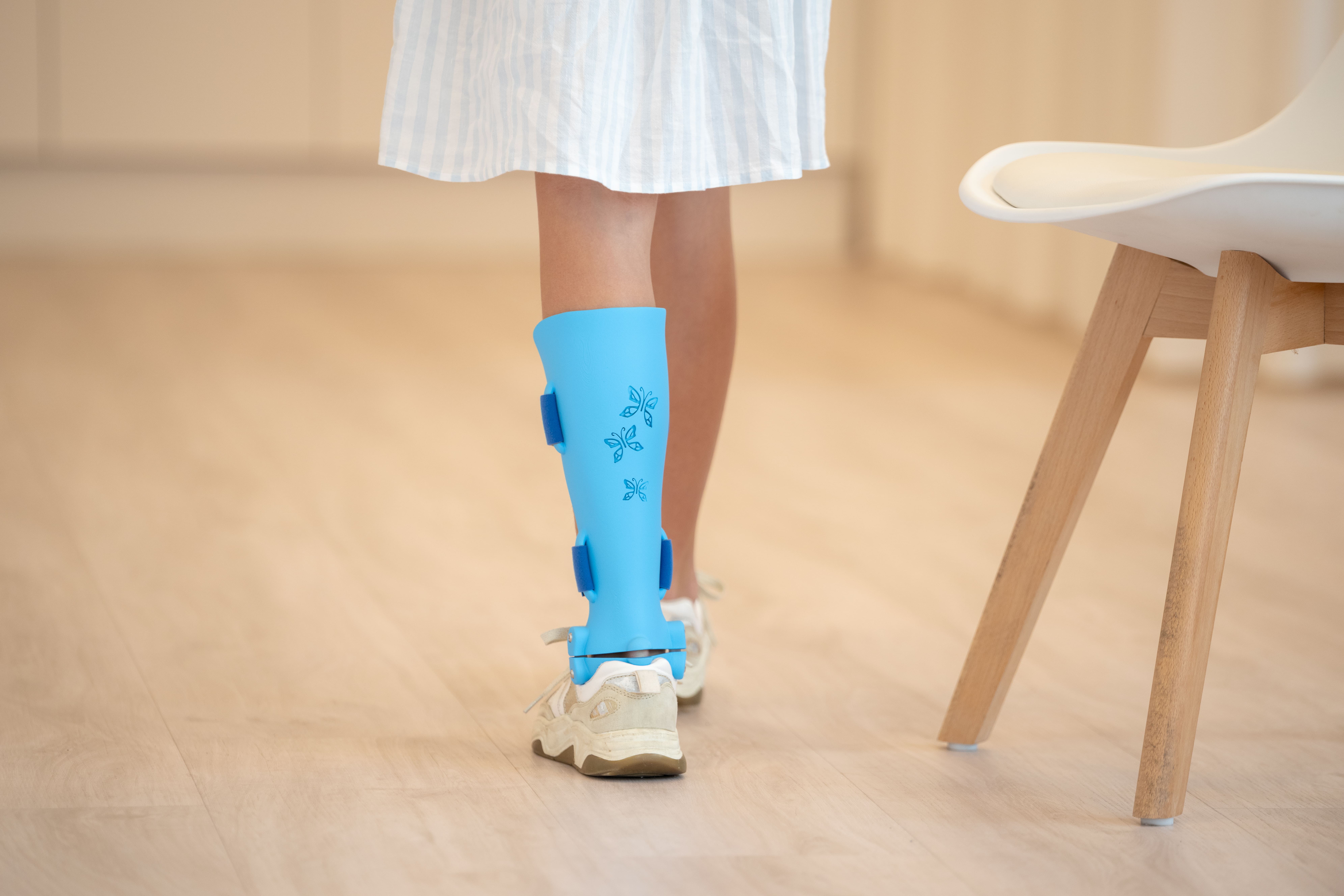 Young patient wearing a blue 3D-printed, custom orthosis with butterfly design, standing in sneakers