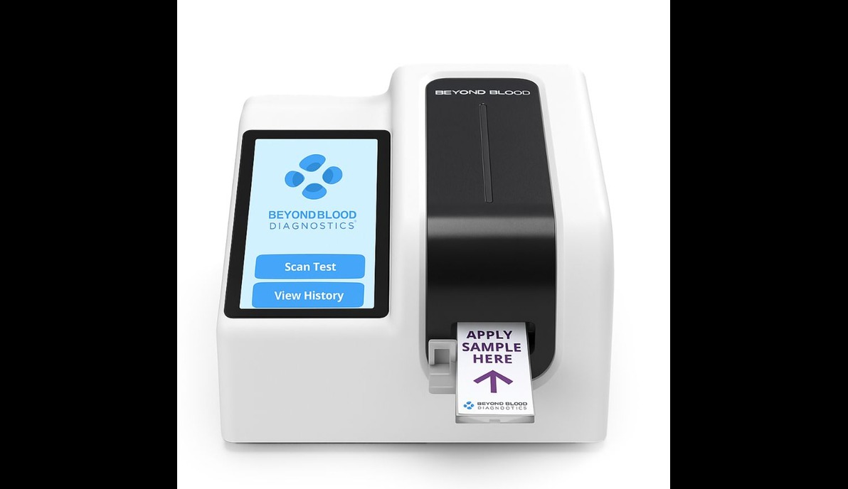 Tired but Blood Tests Normal: A Guide to Next Steps 2026