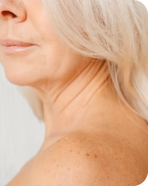 Close-up of a mature woman's lower face, neck, and shoulder with light skin and blonde hair.