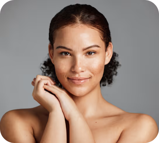 Smiling woman with curly hair and clear skin posing with hands near her face against a gray background.