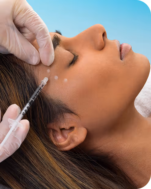 Woman receiving a Botox injection on her temple with white marker dots indicating injection points.