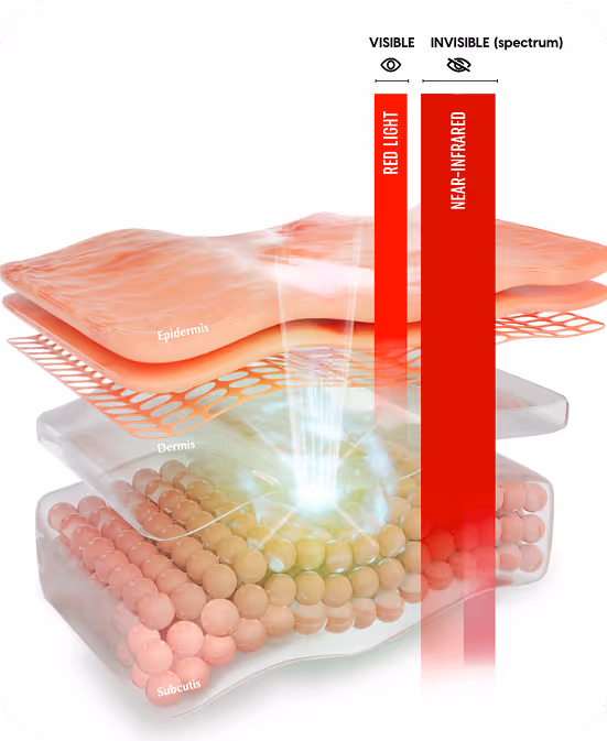 Diagram showing skin layers labeled Epidermis, Dermis, and Subcutis with red light visibly penetrating the upper layers and near-infrared light penetrating deeper.