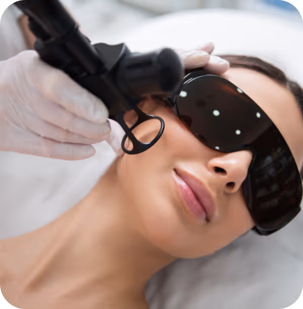 Woman wearing protective goggles receiving a laser skin treatment on her face.