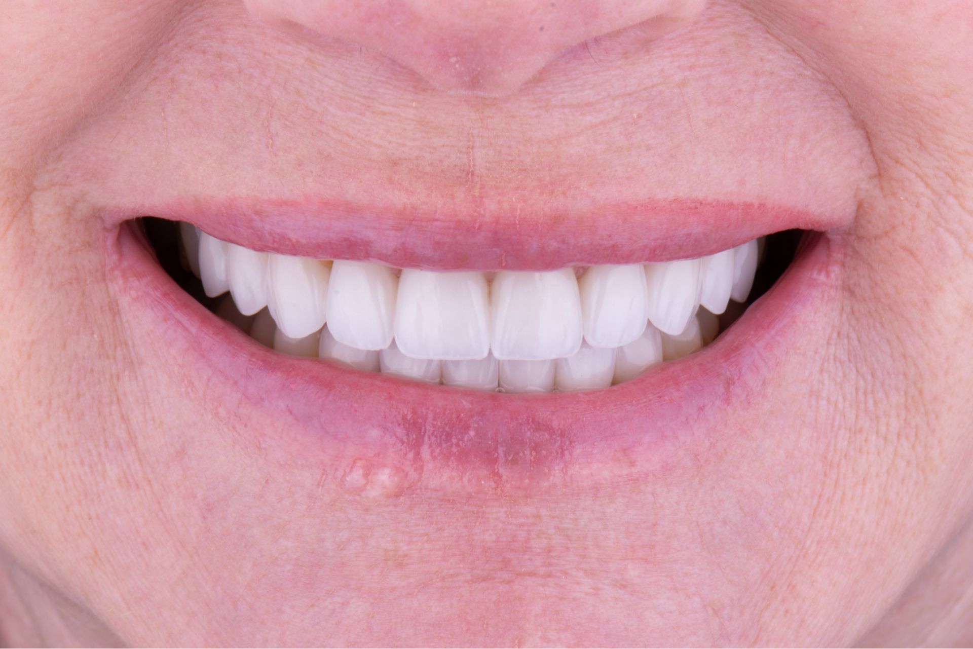 Close-up of a smiling mouth showing clean, white teeth and natural lips.