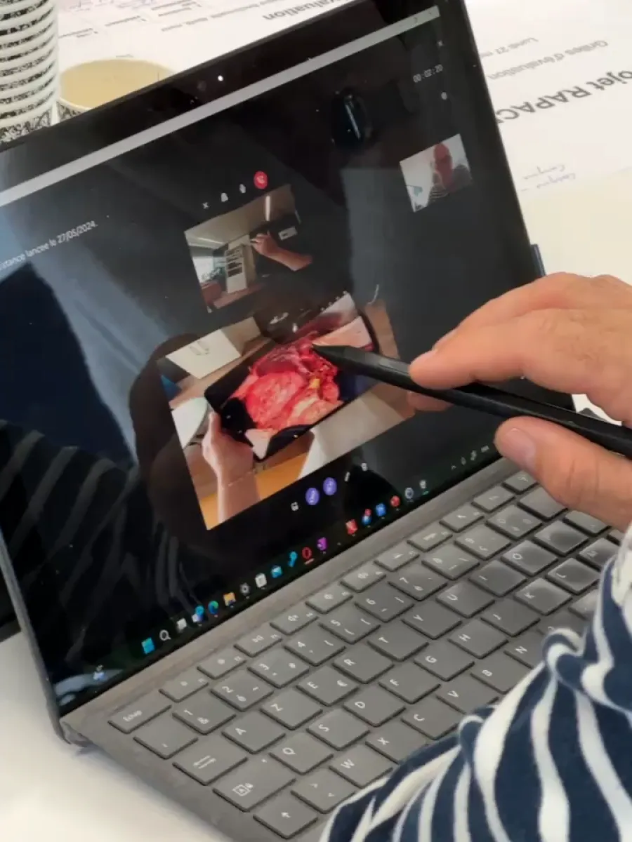 Une main tenant un stylo testant le logiciel de télémedecine sur une surface pro