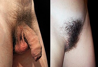 YourRoots Map_Surname_Famous People_Pubic hair