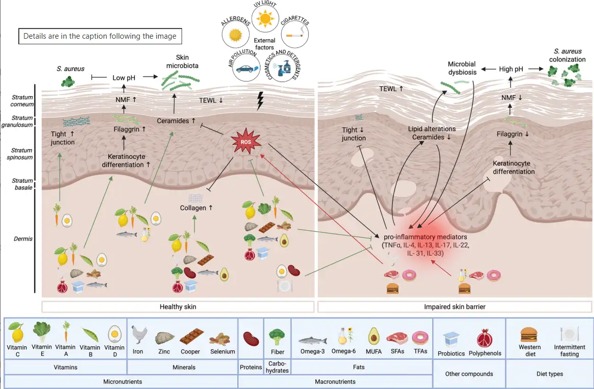 Feeding the Skin Barrier: The Impact of Macro- and Micronutrients on Skin Barrier Function