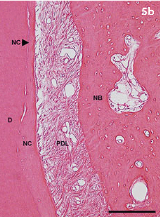 At higher magnification, the periodontal ligament has interwoven collagen fibers and attachment to new bone and cementum