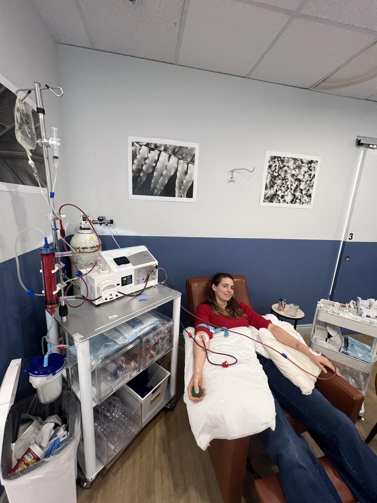 A patient receiving EBOO (extracorporeal blood ozonation) therapy at Upper Room Clinic, both arms connected to the continuous-flow ozone and UV blood circuit.