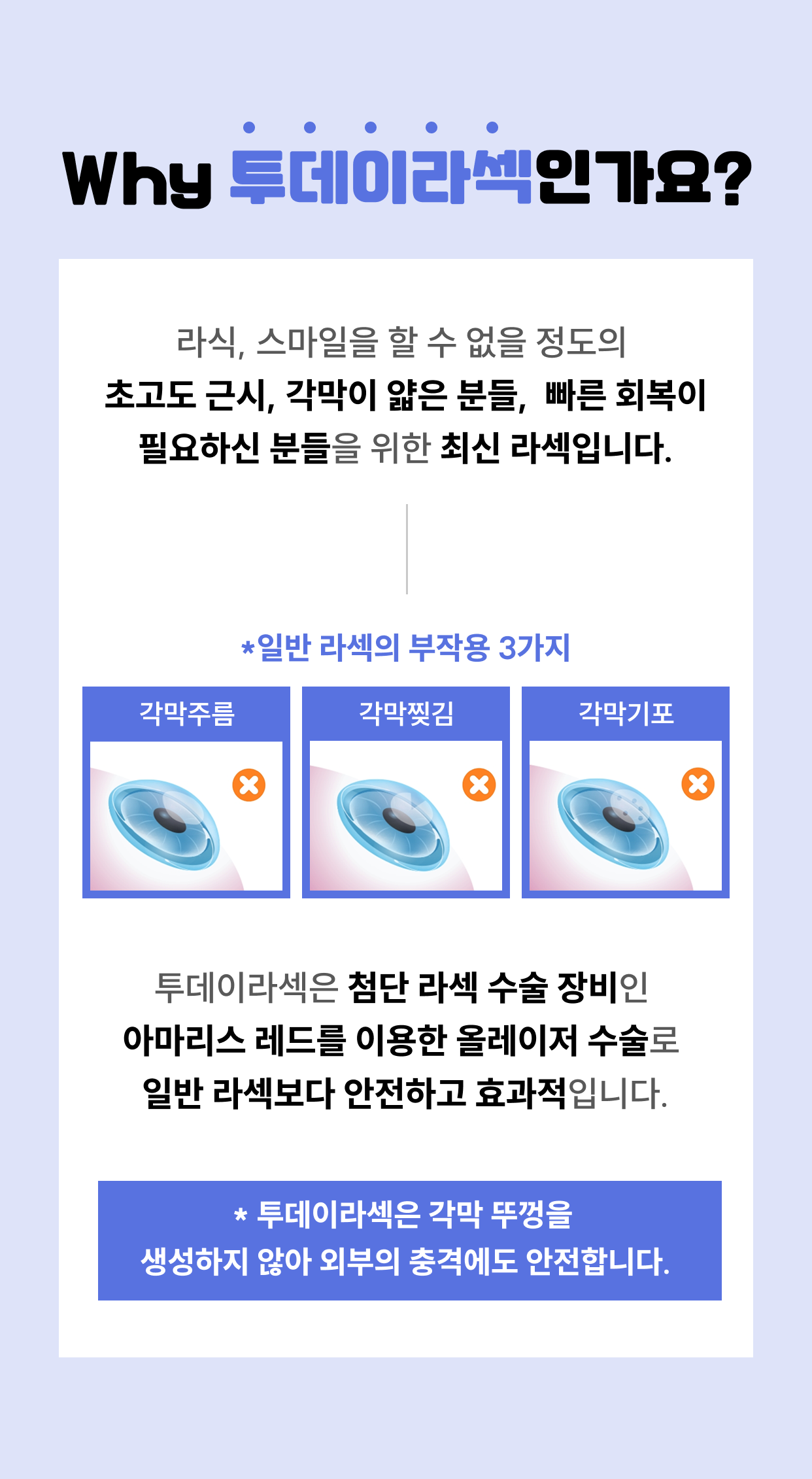 스마일라식 이벤트 혜택