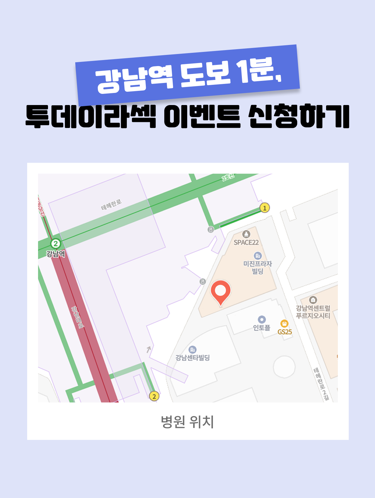 스마일라식 이벤트 혜택