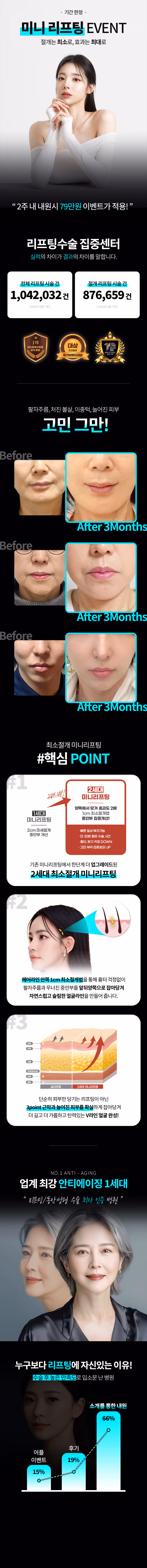 스마일라식 이벤트 혜택