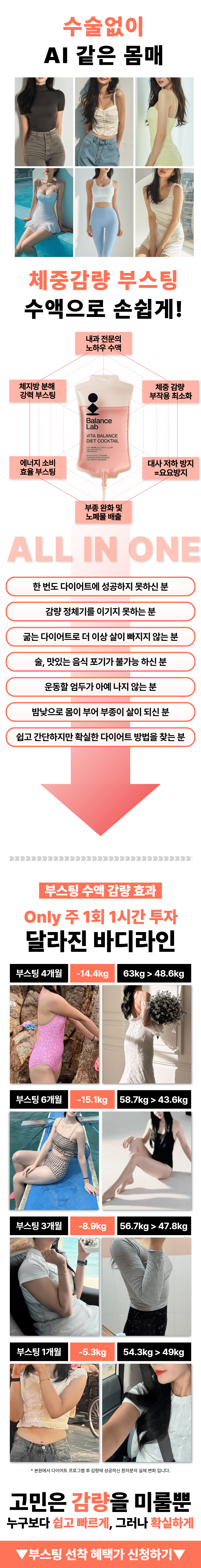 스마일라식 이벤트 혜택