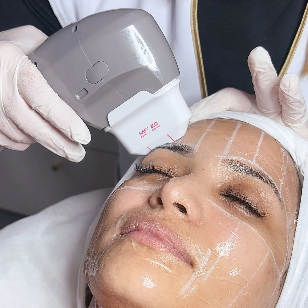 Best Treatment for Skin Laxity HIFU