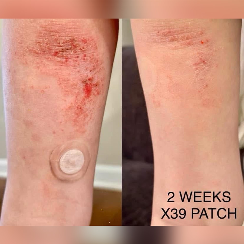 copper peptides before and after