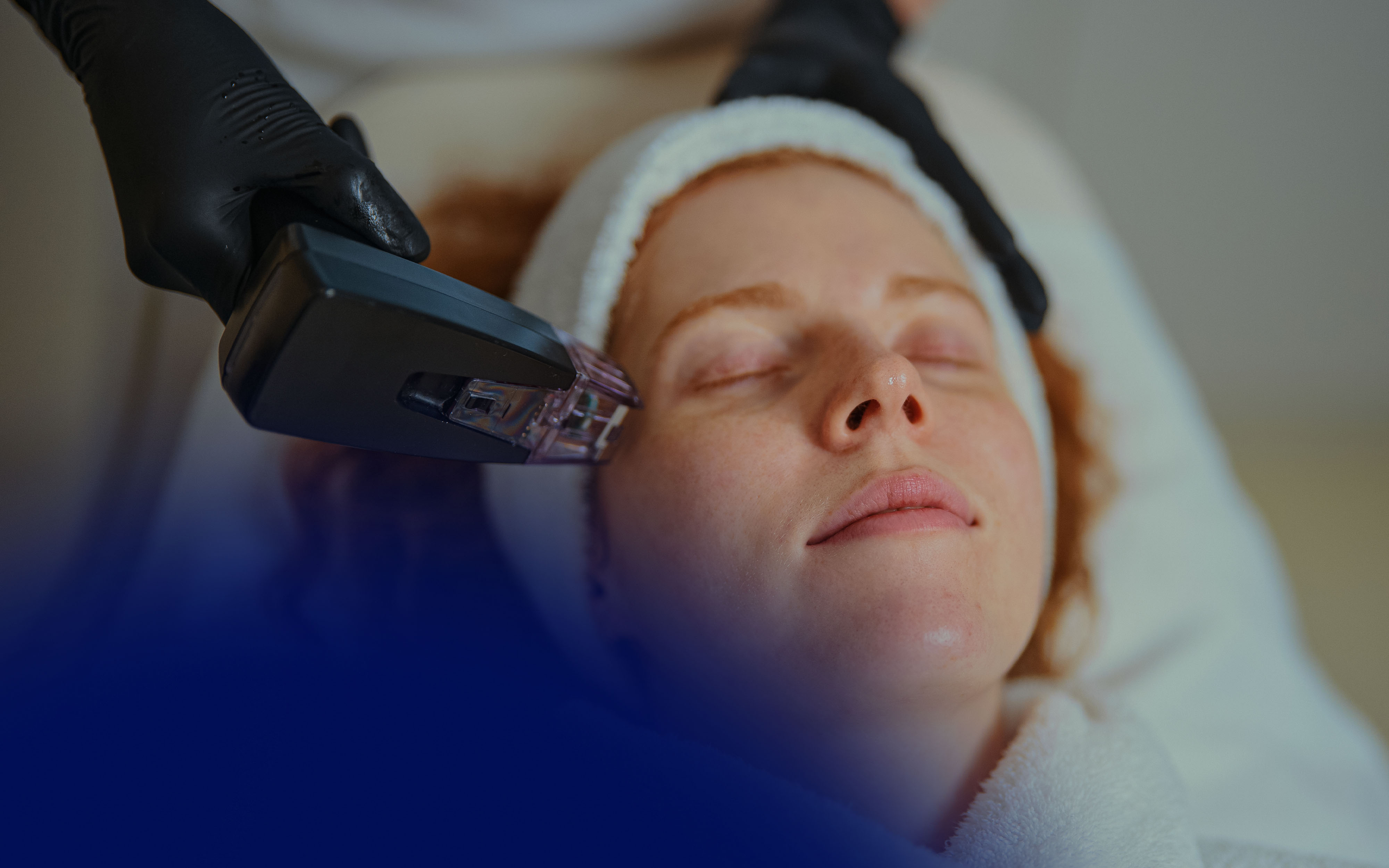 Microneedling with Sculptra Before and After: Clinical Benefits, Protocols, and Patient Outcomes
