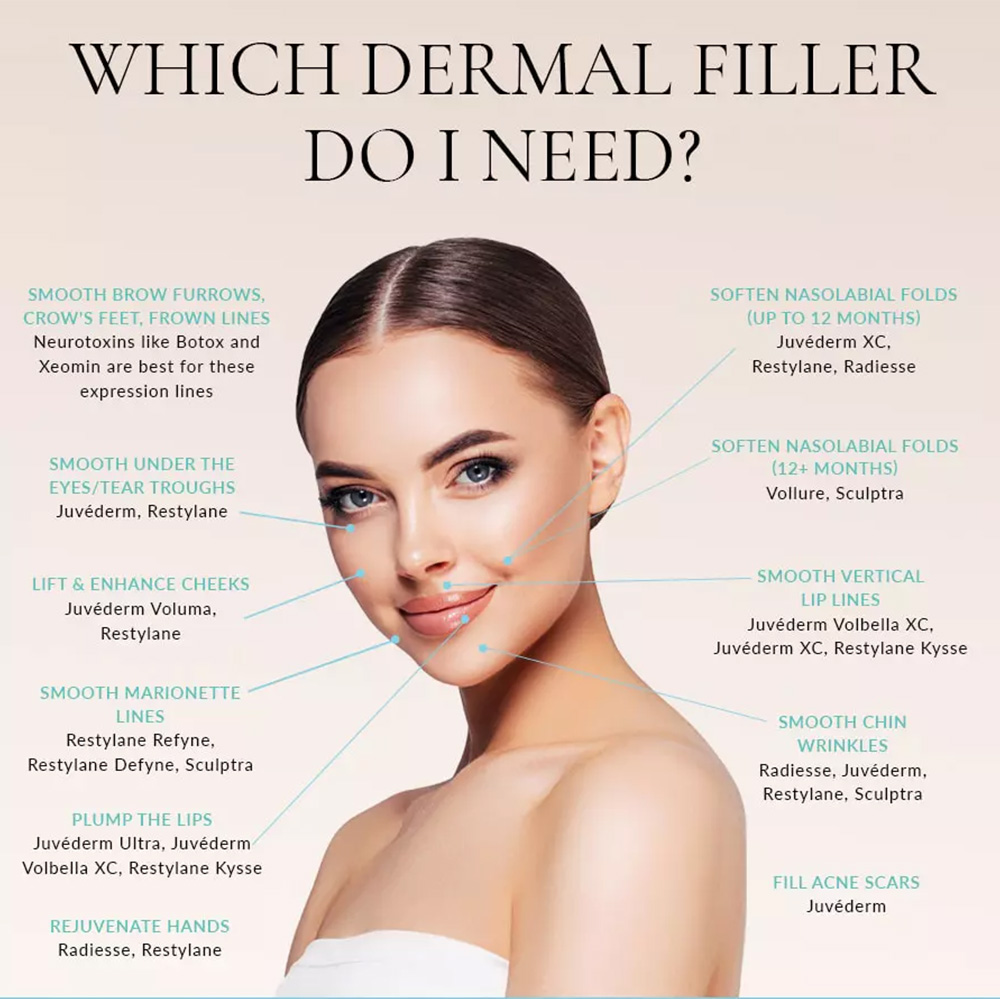 radiesse filler vs juvederm