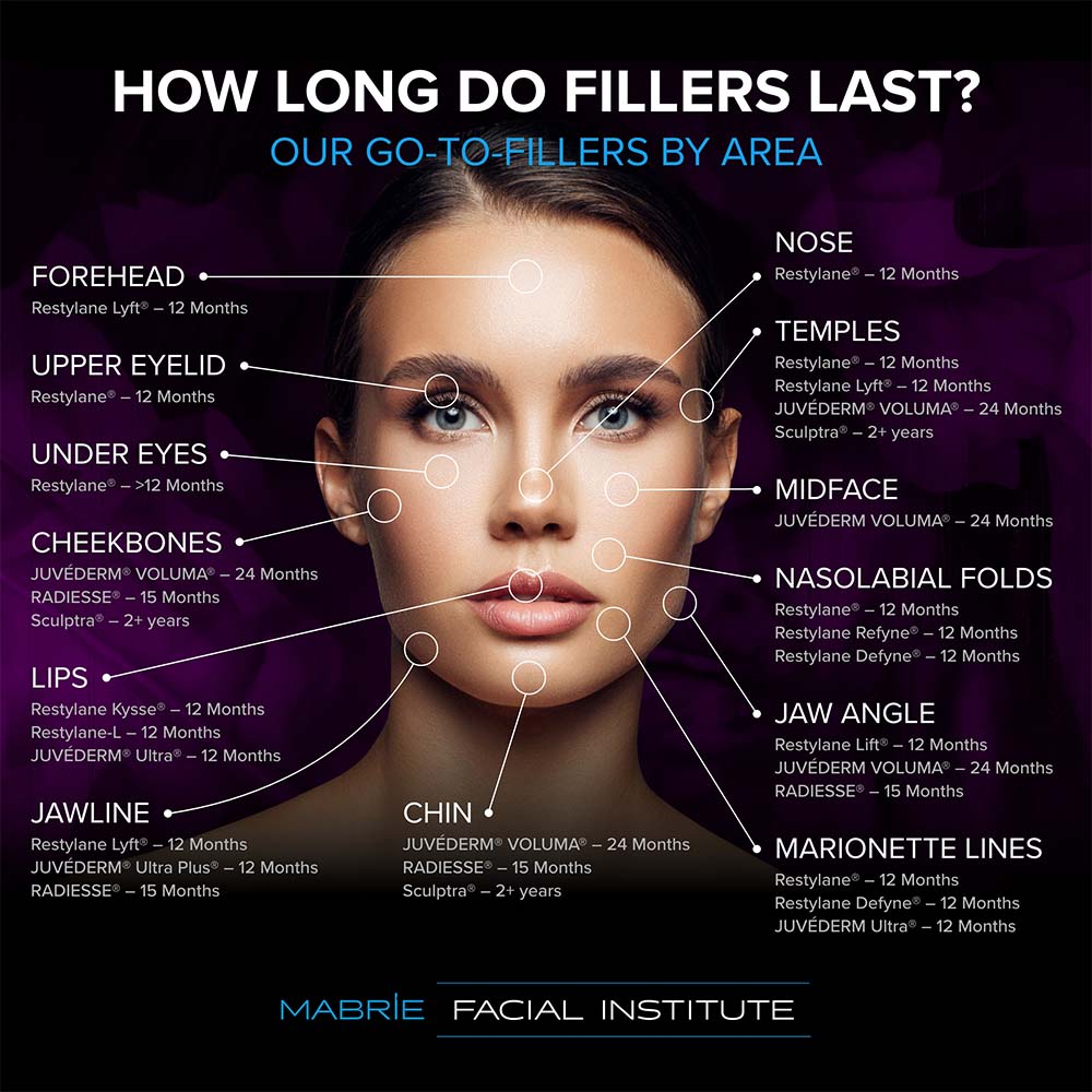 how long do filler last