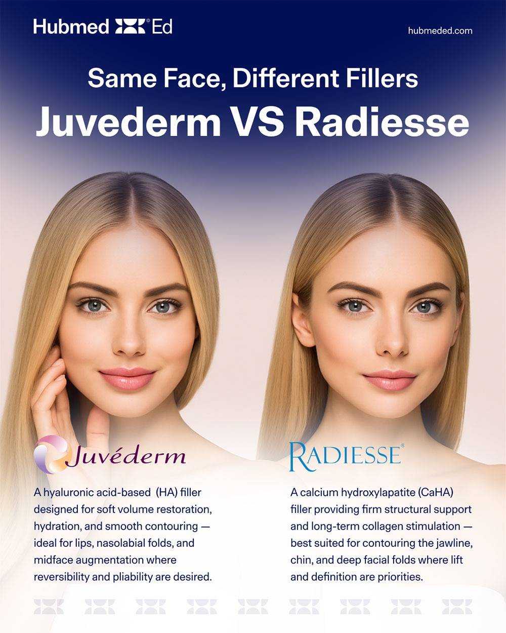 radiesse filler vs juvederm