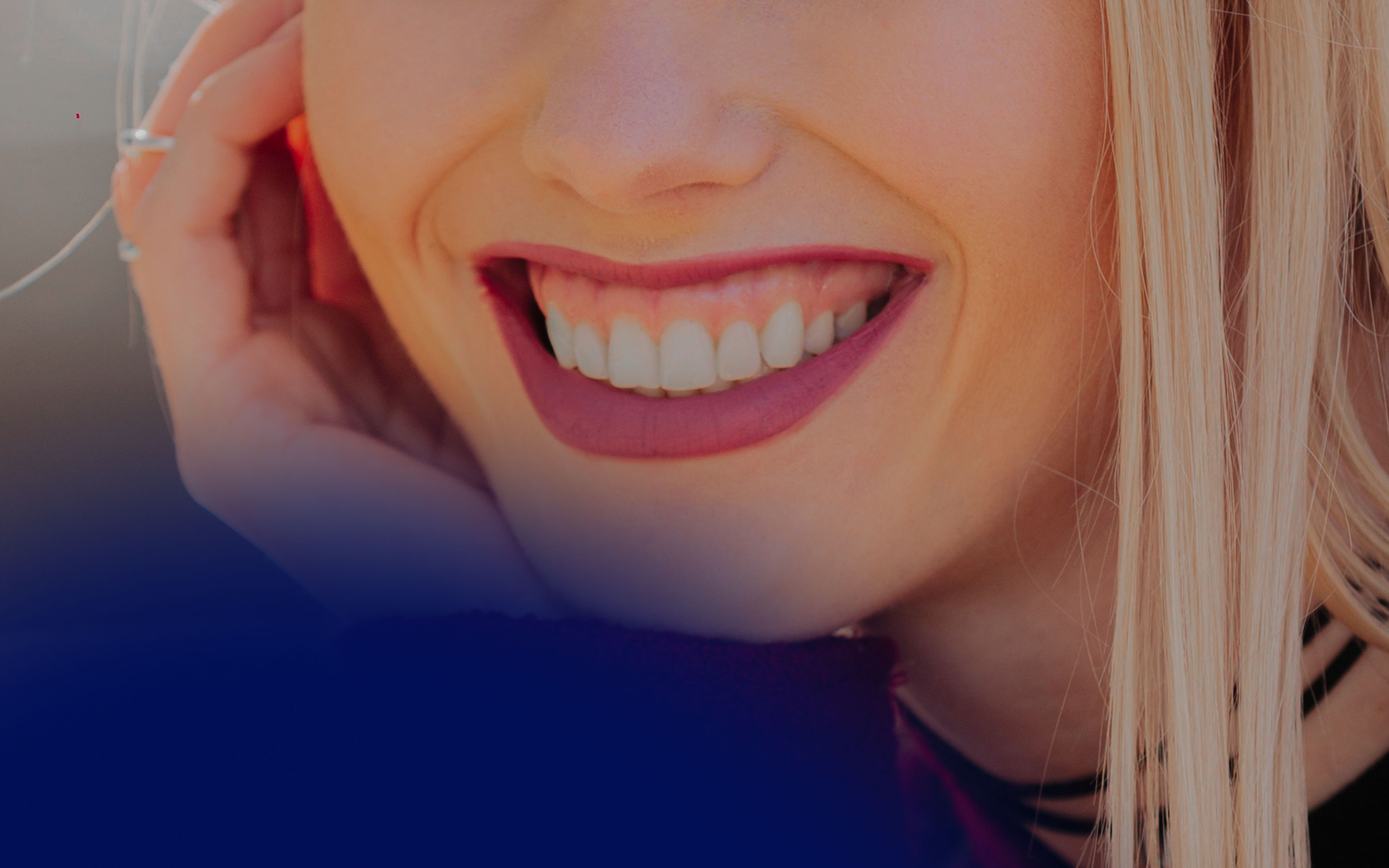 Juvederm for Gummy Smile: Correction Guide