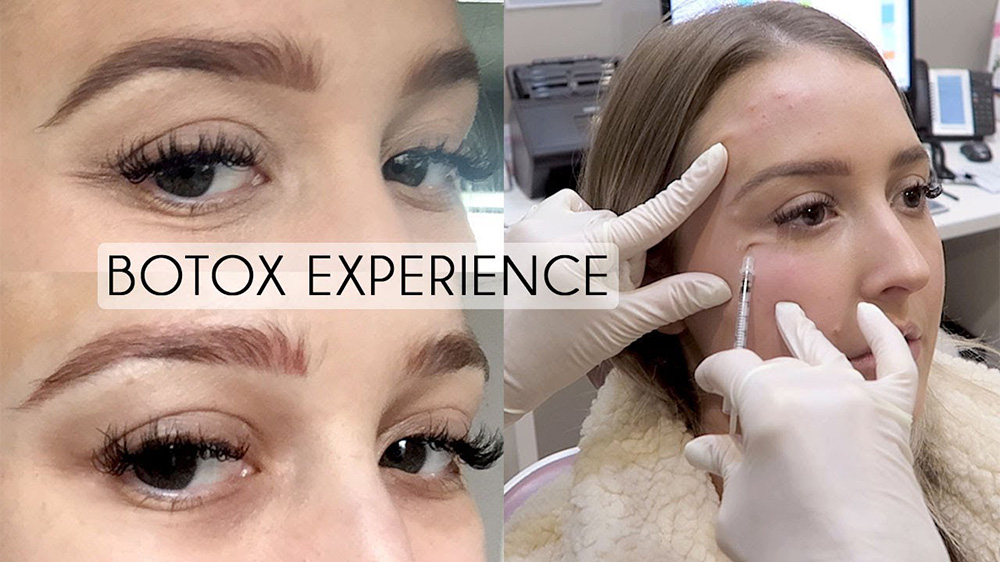 botox for under eye bags