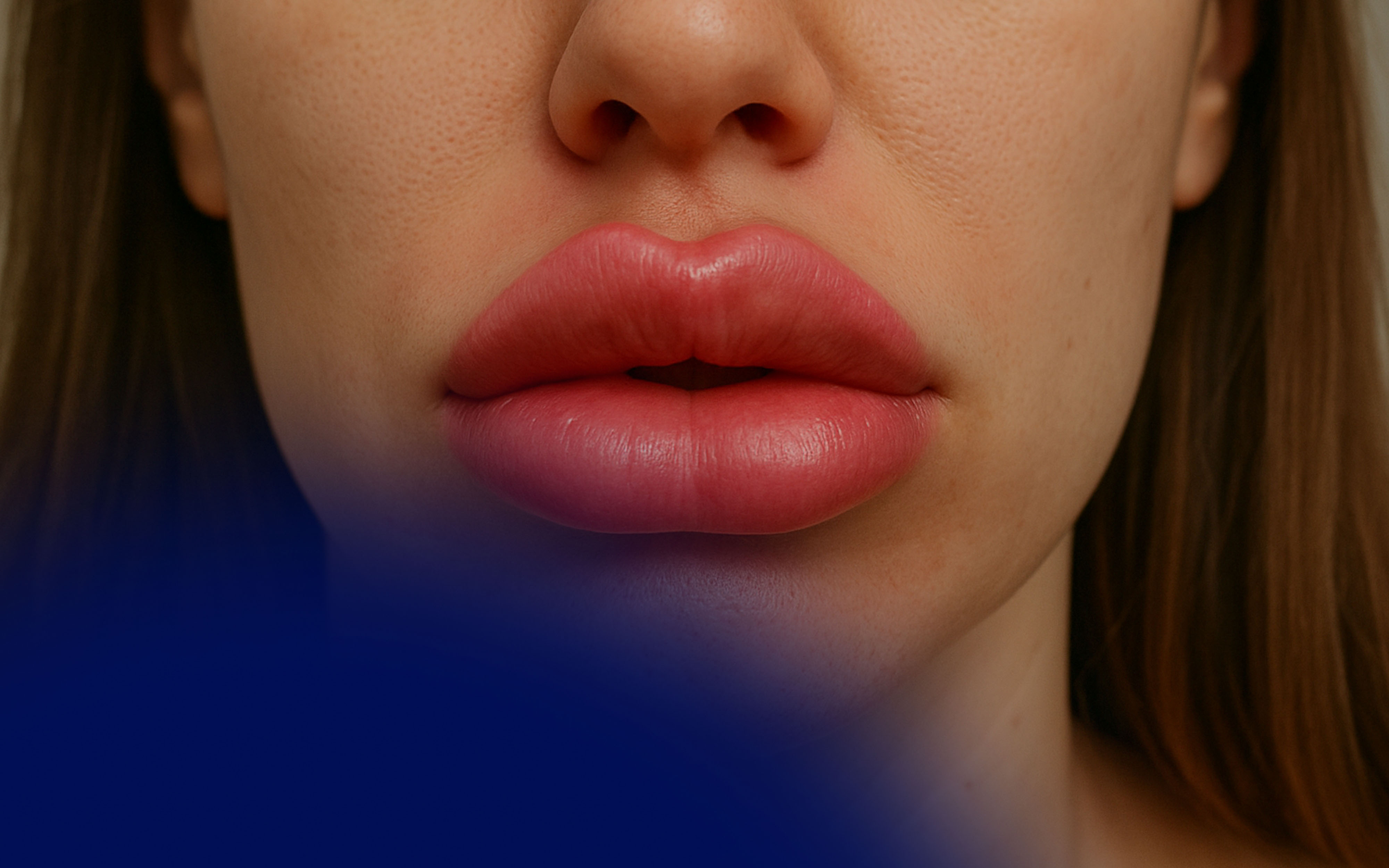 Bad Lip Filler – What to Do in a Lip Filler Gone Wrong Scenario
