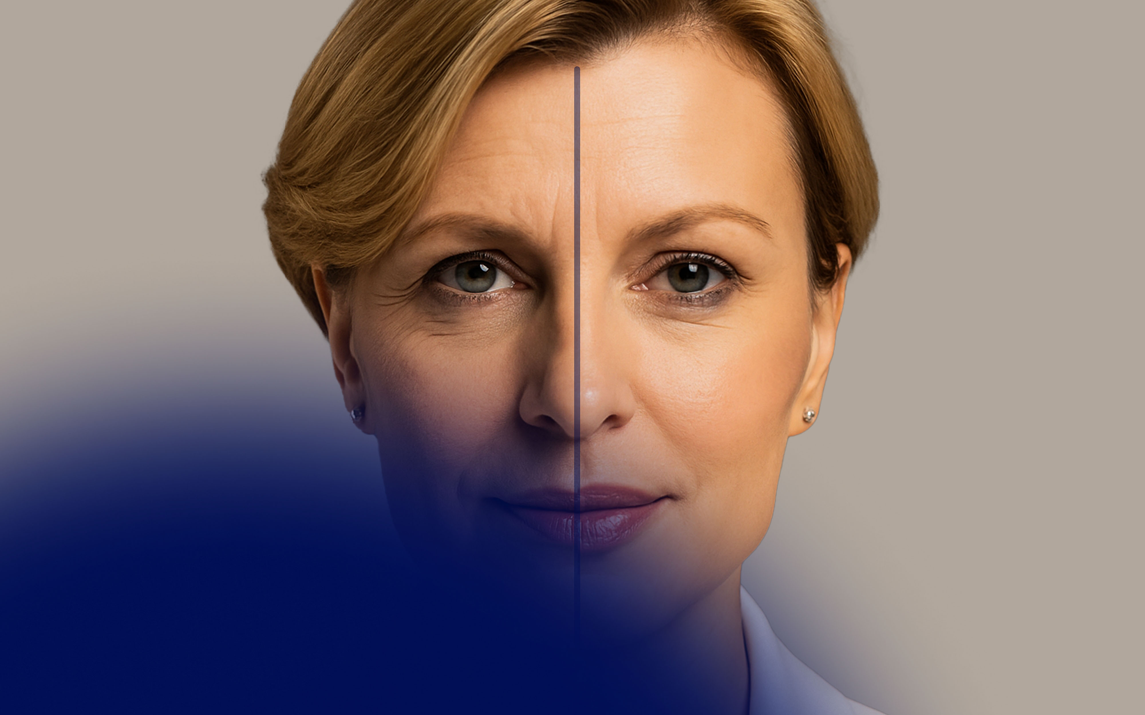 Liquid Face Lift Before and After Outcomes