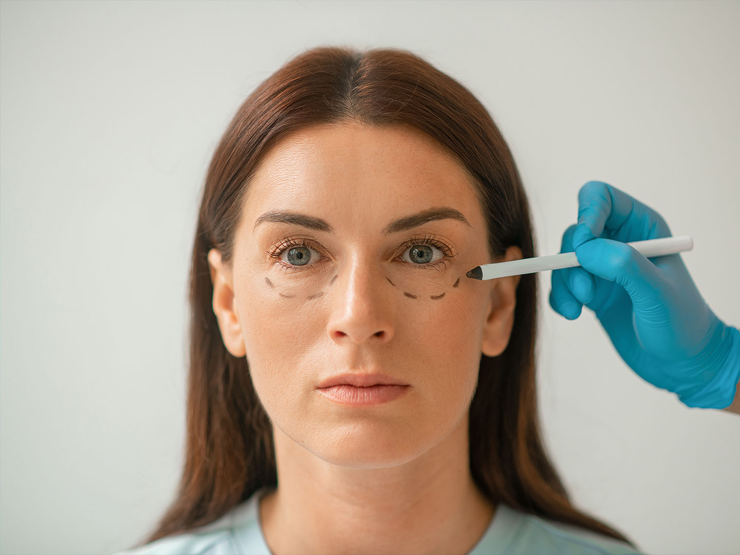 Under Eye Filler Before and After: Clinical Outcomes, Techniques, and Insights