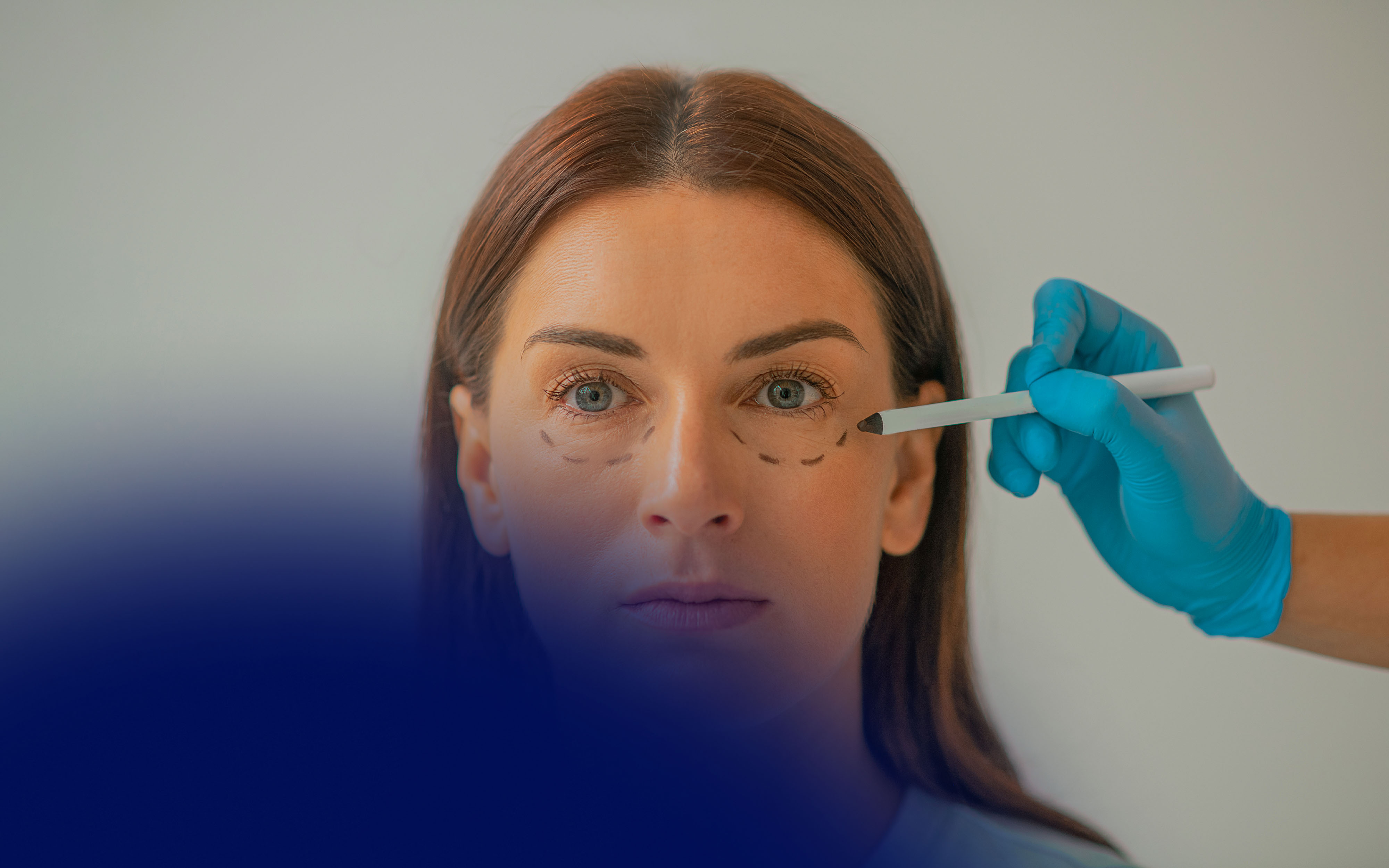 Under Eye Filler Before and After: Clinical Outcomes, Techniques, and Insights