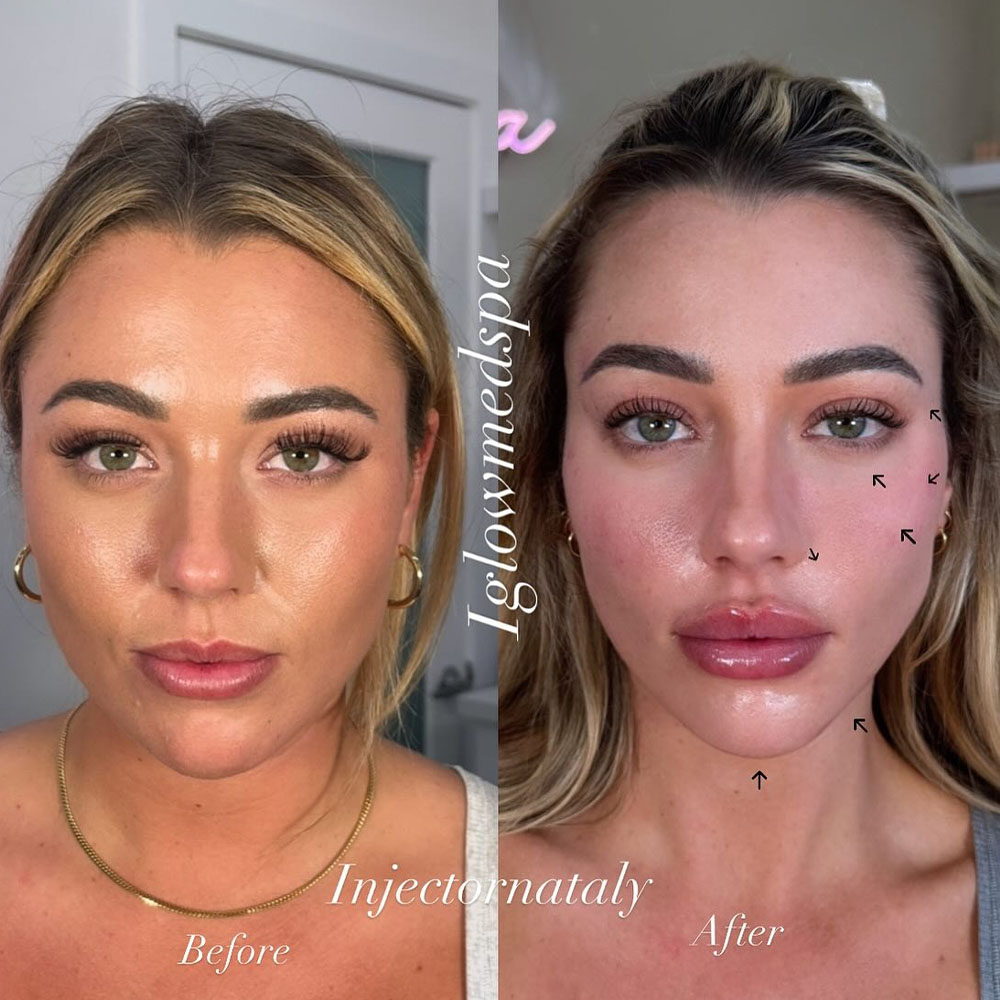 facial balancing