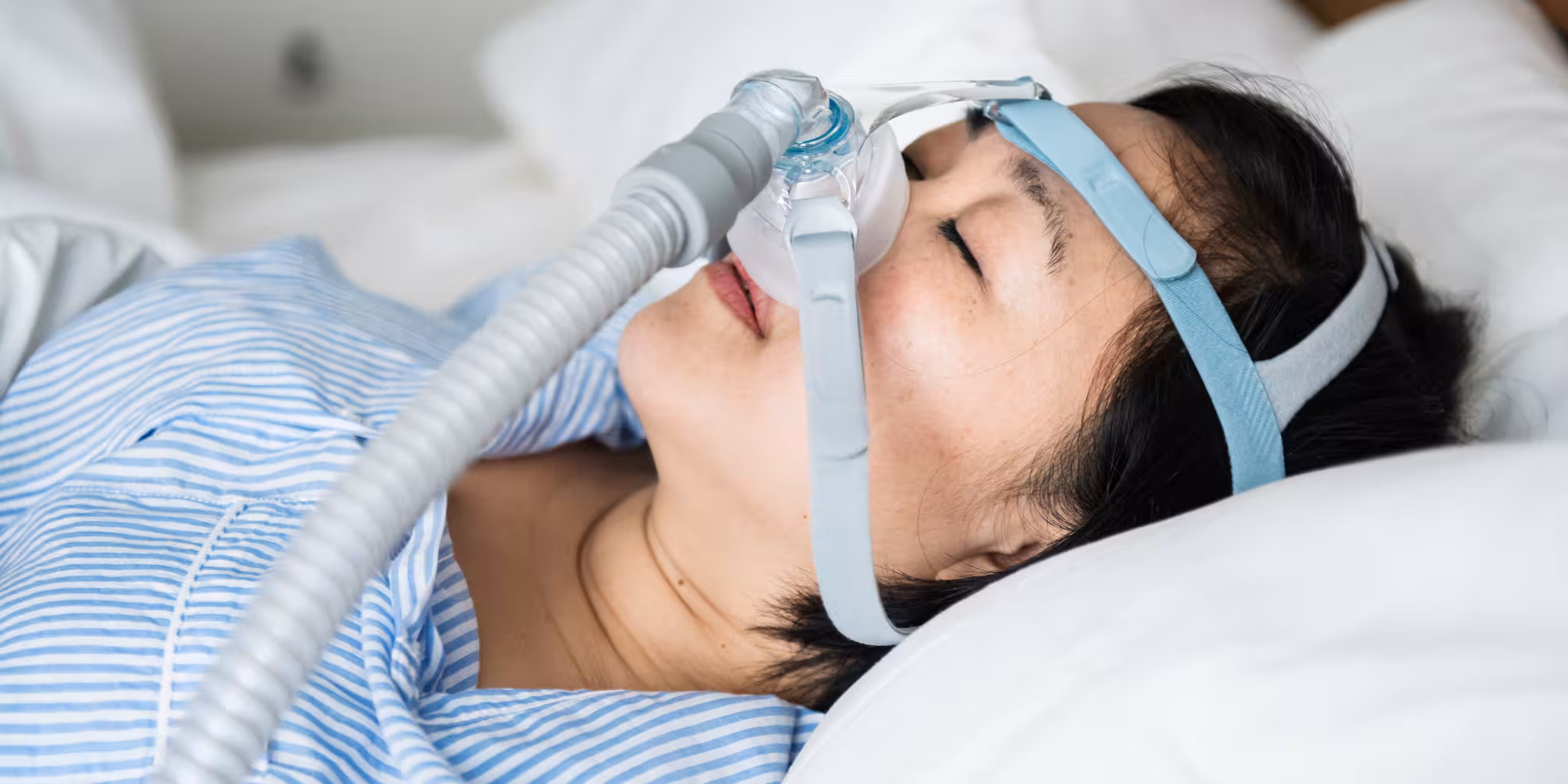 Sleep Apnea: What It Is, Causes, Symptoms & Treatment