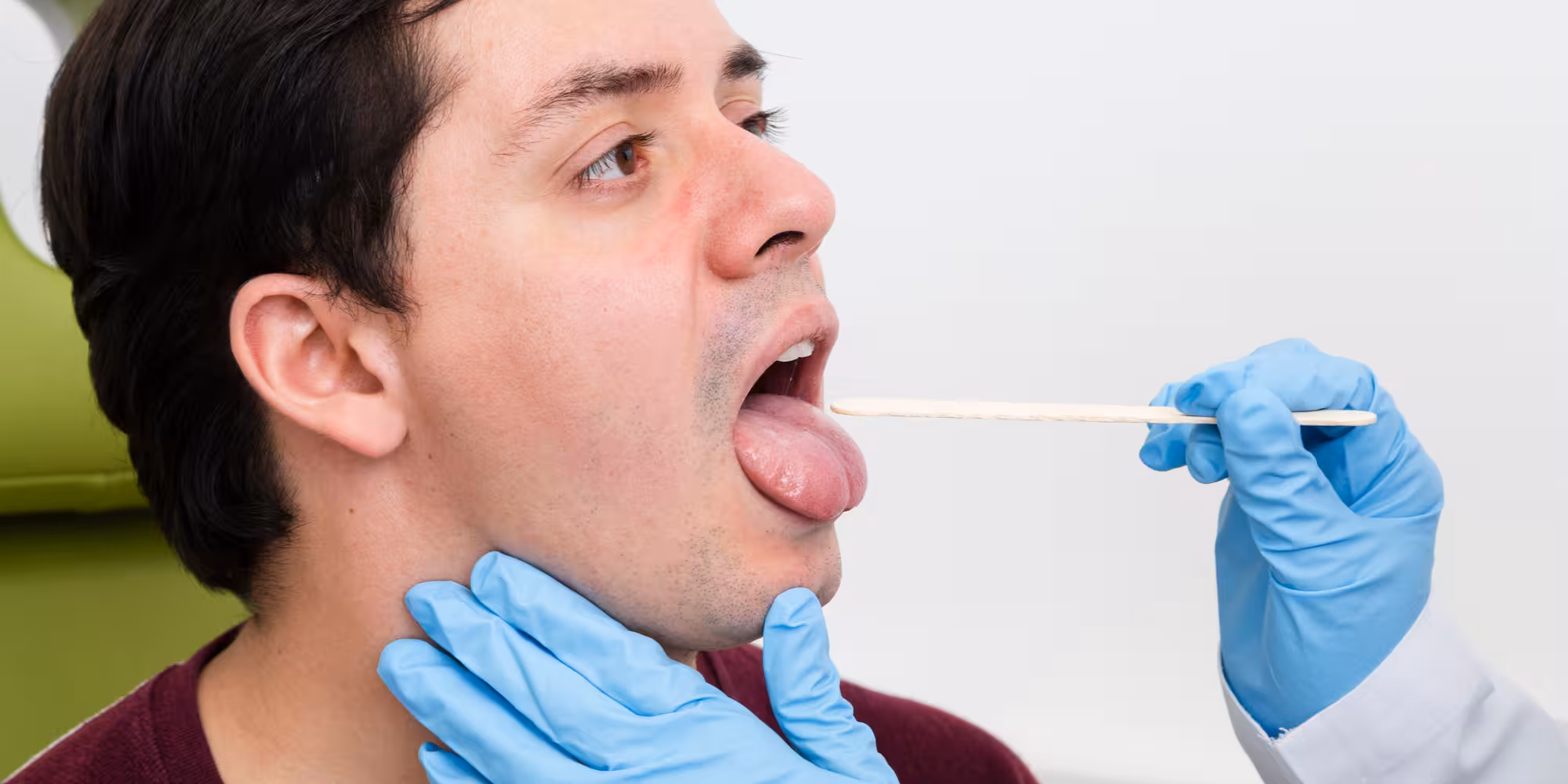 Tonsil Stones: Symptoms, Causes, Removal & Treatment