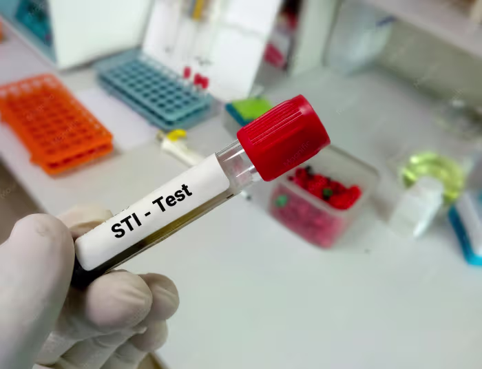 Private STI Test Cost UK