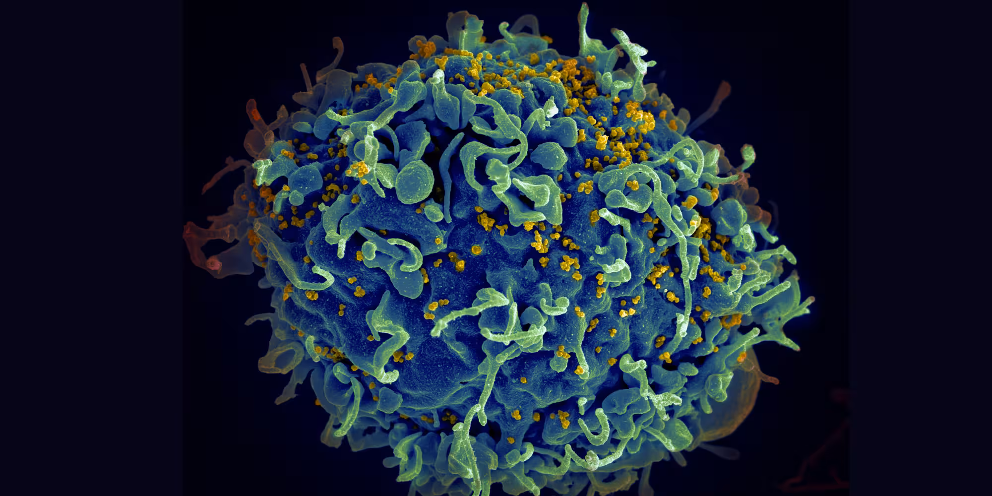 HIV