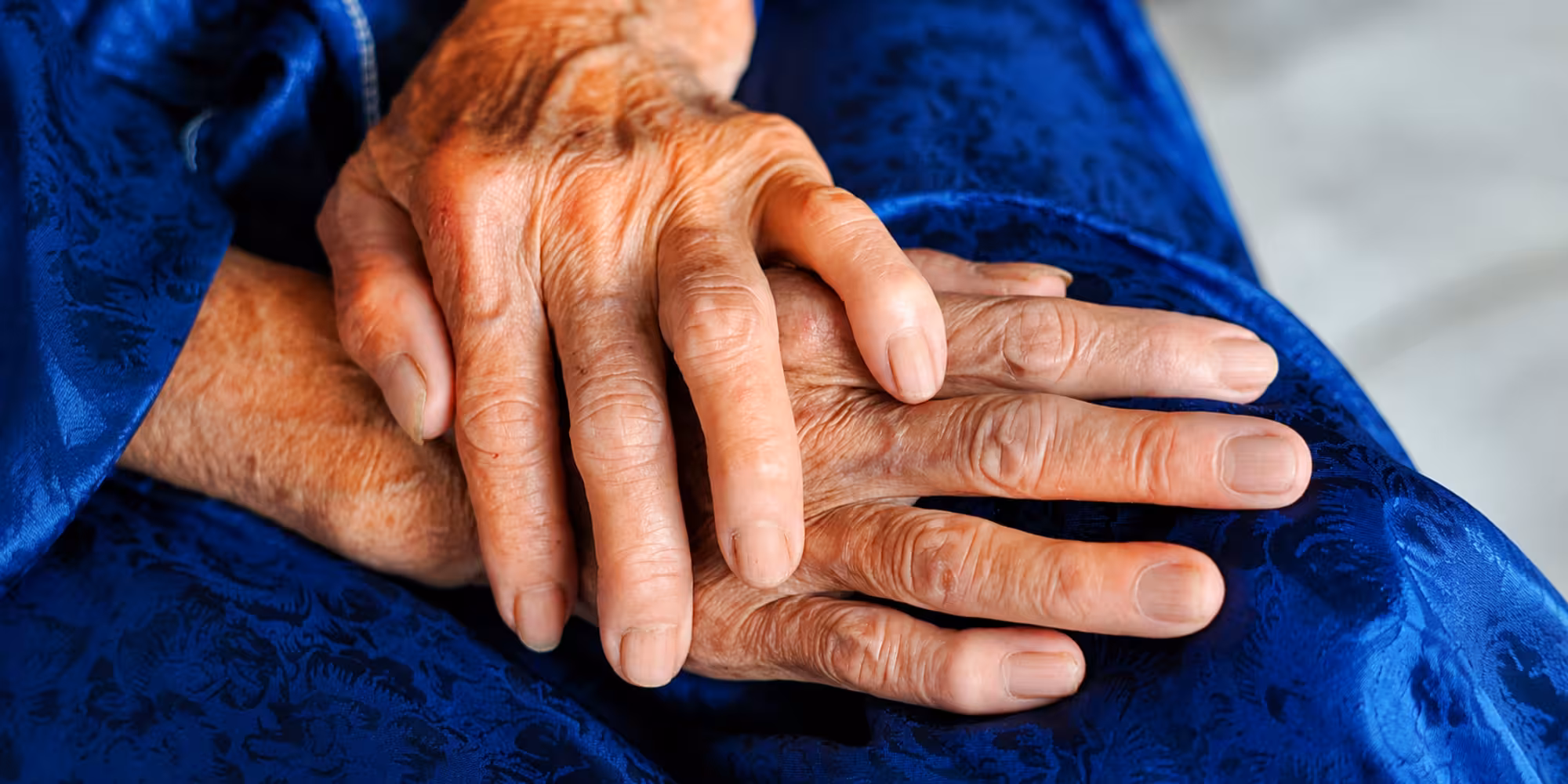 Rheumatoid Arthritis