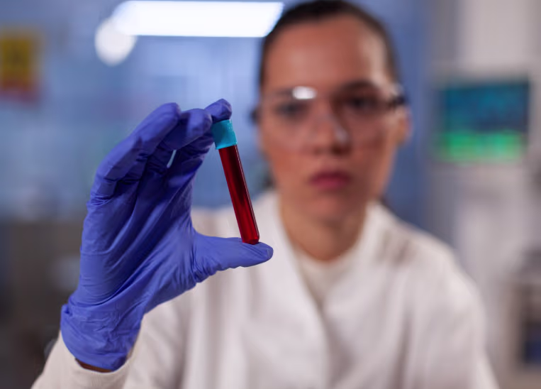RDW Blood test