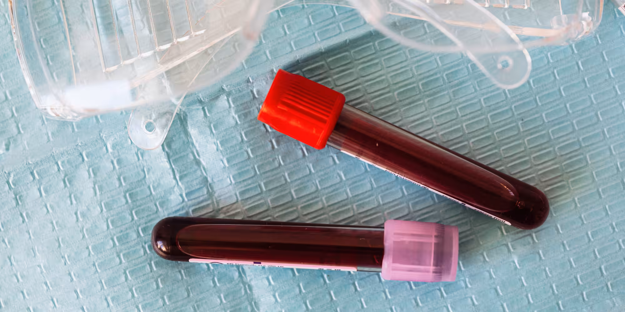 What Can Cause Abnormal Blood Test Results?