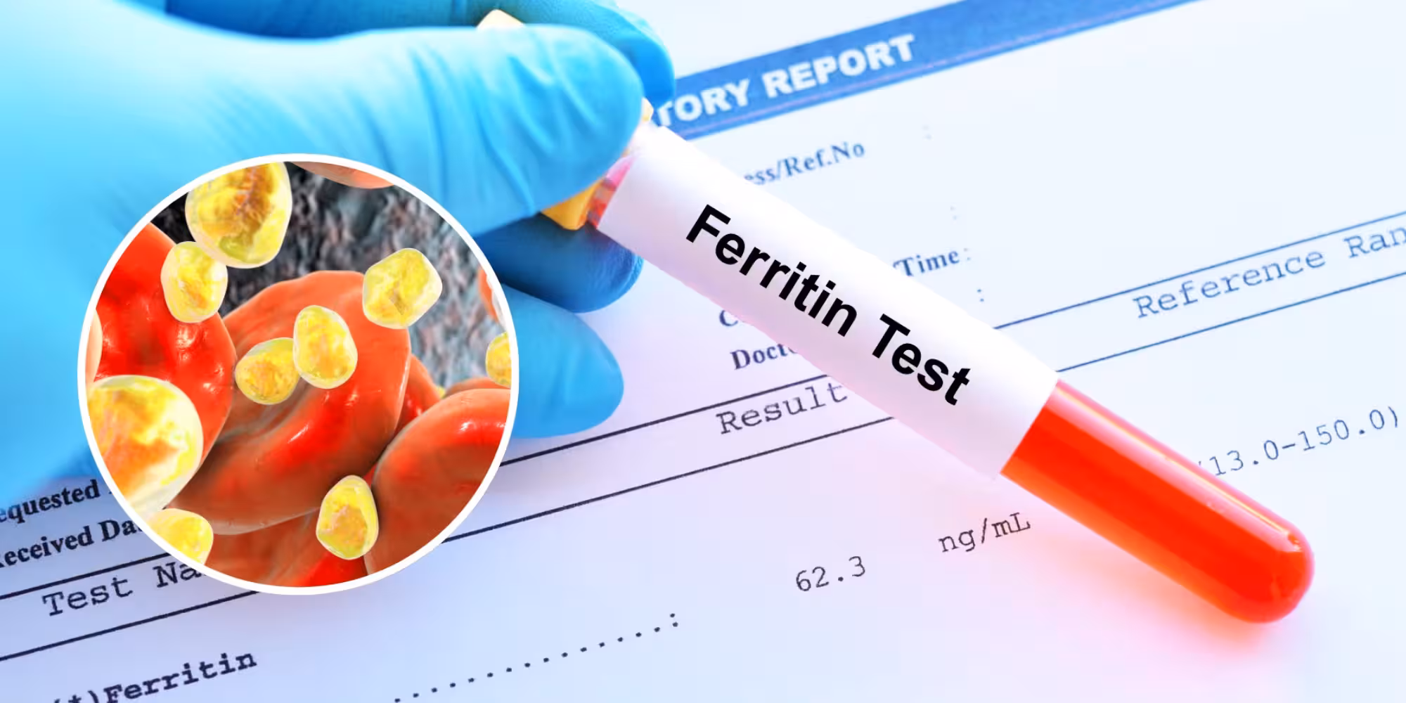 What Is a Ferritin Blood Test? Meaning, Results and What's Normal