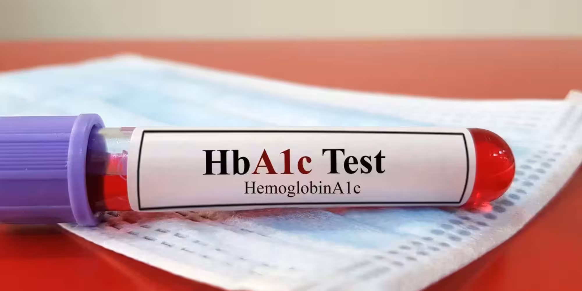 What Is an HbA1c Blood Test? Meaning, Results and What's Normal