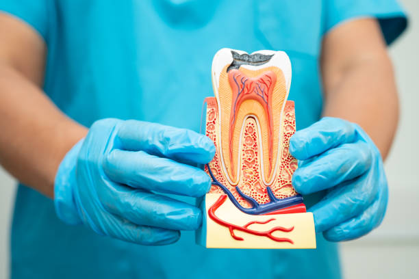Asian dentist holding dental implant, artificial tooth roots into jaw, root canal of dental treatment, gum disease, teeth model for dentist. Asian dentist holding dental implant, artificial tooth roots into jaw, root canal of dental treatment, gum disease, teeth model for dentist. healthy teeth tooth decay stock pictures, royalty-free photos & images
