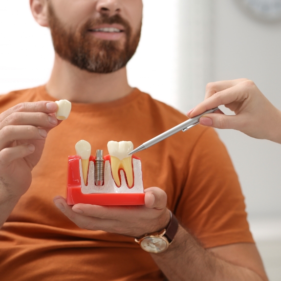 Dental Implants Massapequa Park | Replace Missing Teeth | Cost of Dental  Implants | Smile Creations