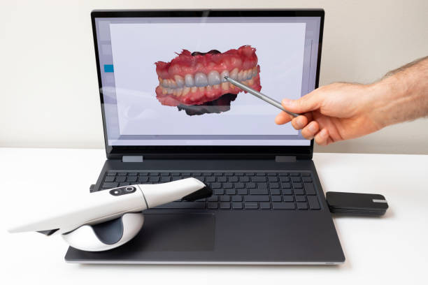 Dentist Shows 3D Scanned Picture of Scanned Teeth on Monitor of Computer. White 3d Intraoral Dental Tooth Scanner Lying on Table. Dental Equipment, Device For Scanning Teeth. Dentistry. Horizontal Dentist Shows 3D Scanned Picture of Scanned Teeth on Monitor of Computer, White 3d Intraoral Dental Tooth Scanner Lying on Table. Dental Equipment, Device For Scanning Teeth. Dentistry. Horizontal Digital scan of a tooth being designed on a monitor for a same-day crown stock pictures, royalty-free photos & images